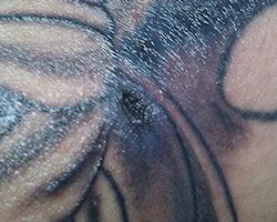 Herida abierta en el tatuaje