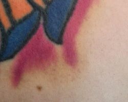 Color amoratado alrededor del tattoo
