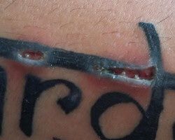 Grietas en el tatuaje