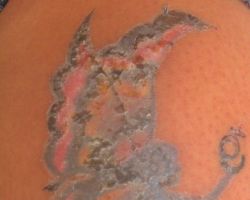 Tatuaje con aspecto blanquecino en proceso de curado