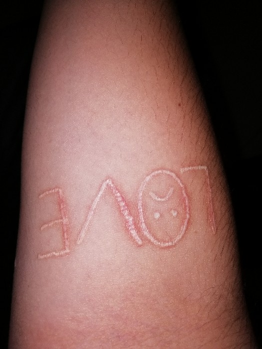 Dudas sobre la cicatrización de un tatuaje de tinta blanca - ZonaTattoos